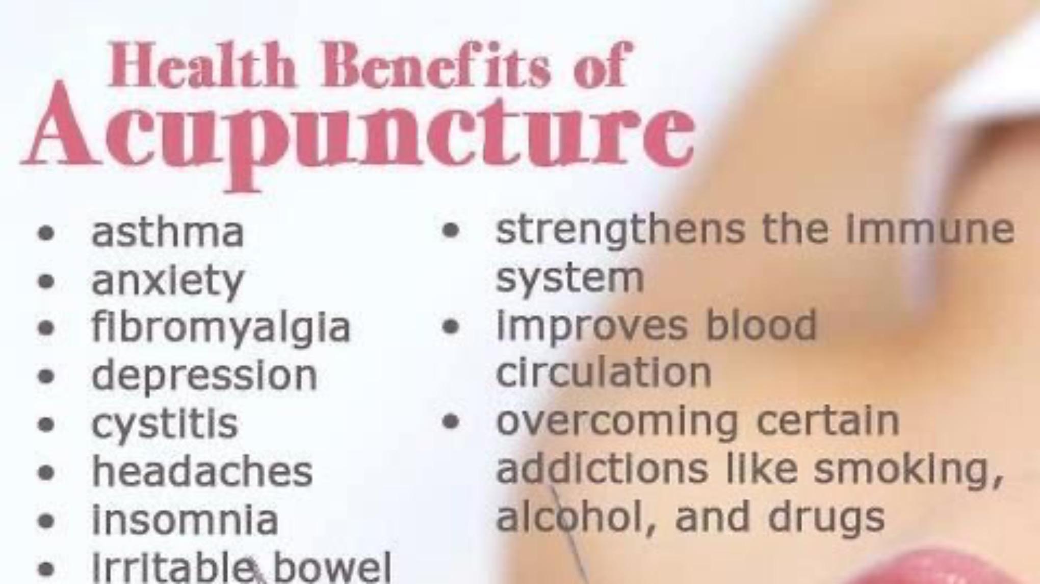 Let’s Talk Acupuncture with Holly