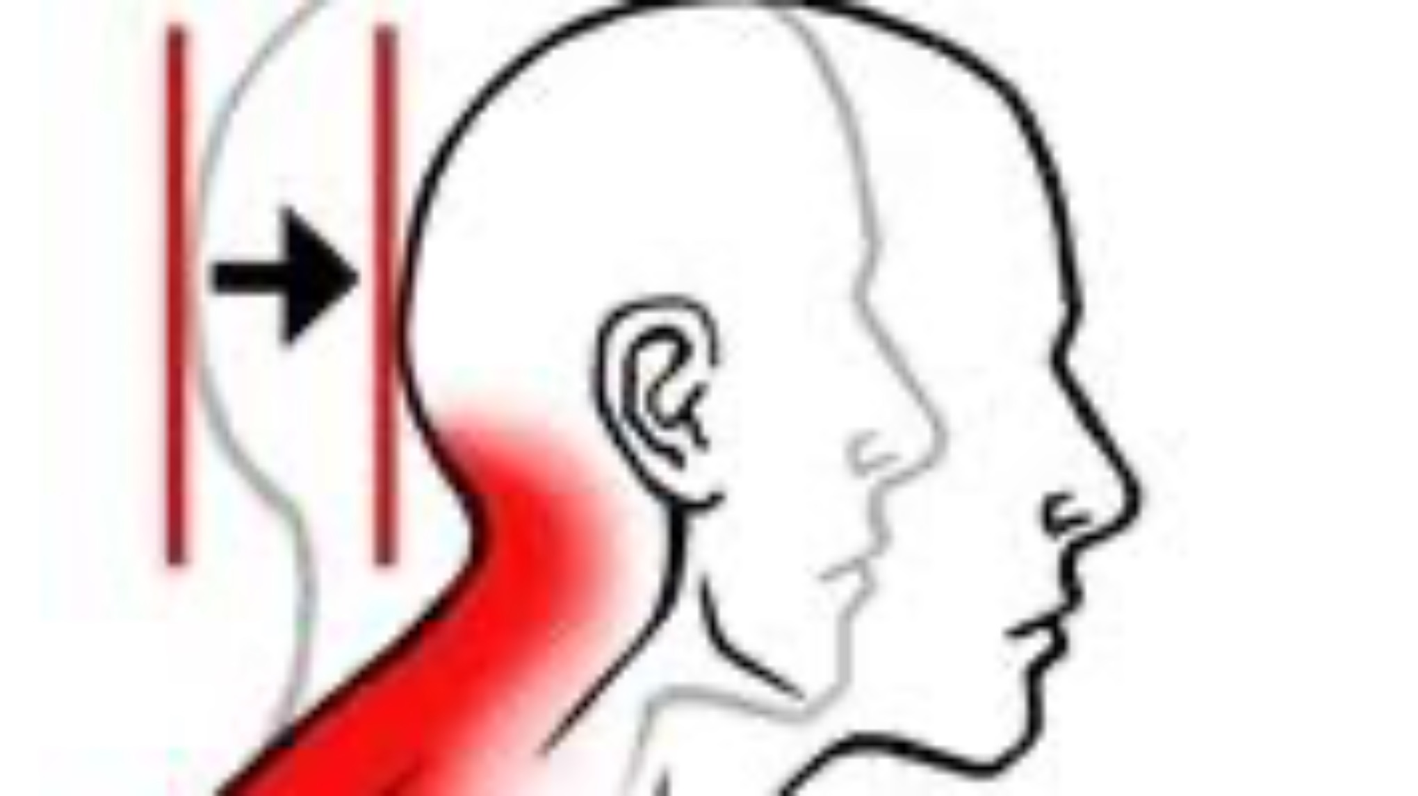 Workshop: Hoofd- & Nekklachten