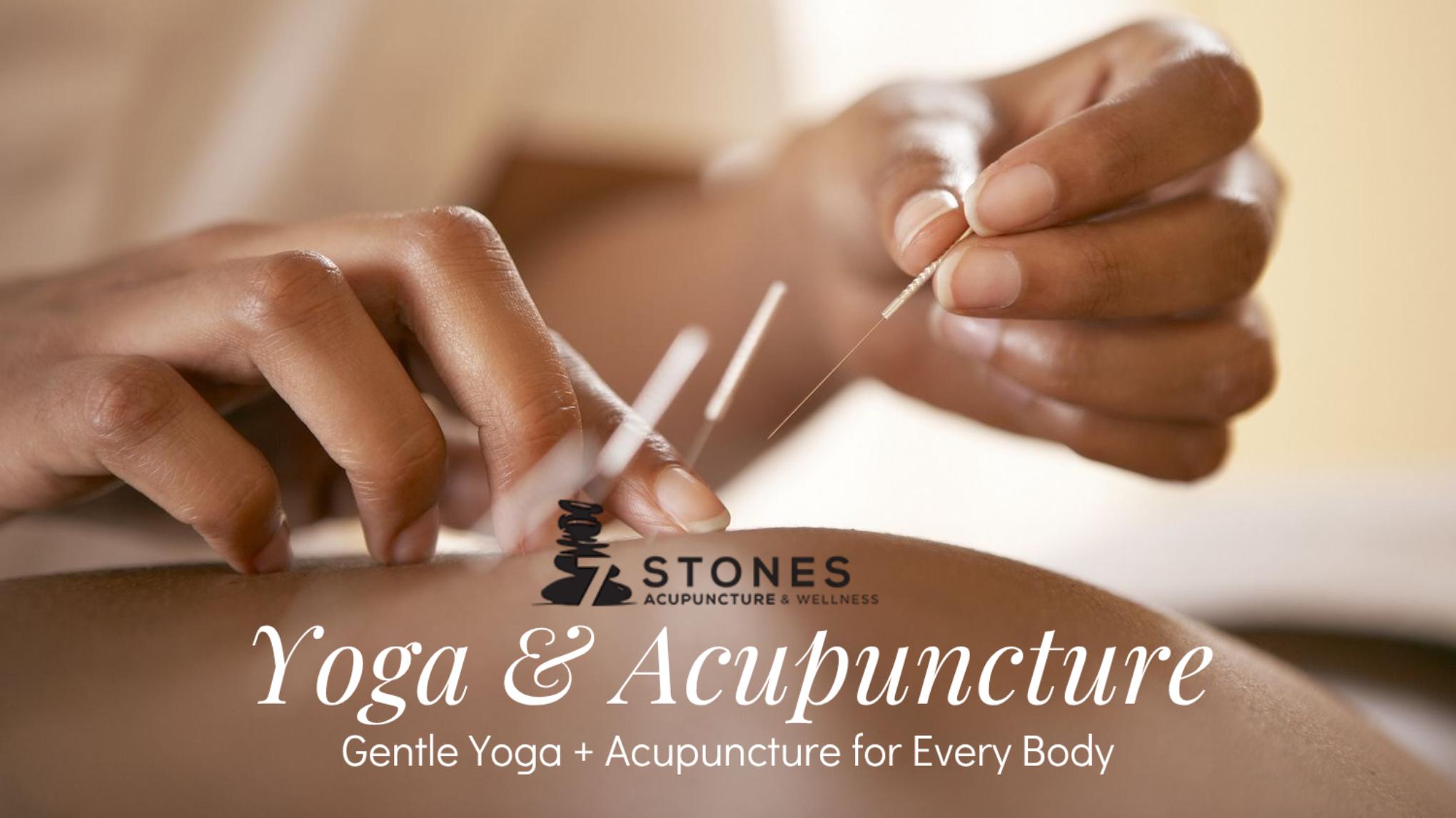 Gentle Yoga & Acupuncture